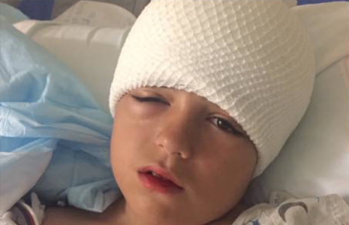 Chute a velo sans casque