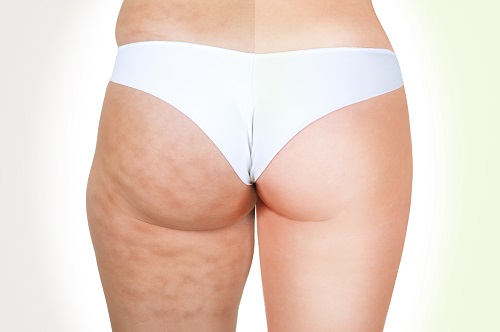 Perdre cellulite avec velo appartement